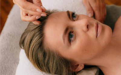 The Needle That Lifts: Why London’s Elite Are Choosing cosmetic Facial Acupuncture Over Fillers