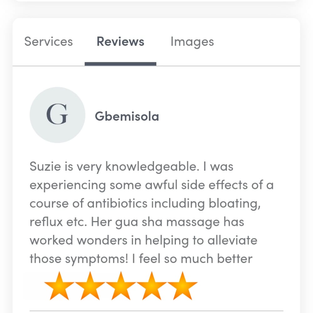 Acupuncture services provided at Wellness Balance